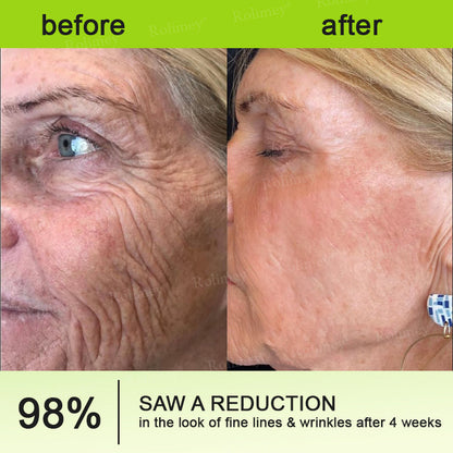 👨‍⚕️Made and shipped from Australia💫 Botox & Vita-A Retinol Shot Wrinkle-Lift Tightening cream - Last Day Promotion 70% OFF