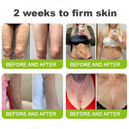 👨‍⚕️Made and shipped from Australia💫 Botox & Vita-A Retinol Shot Wrinkle-Lift Tightening cream - Last Day Promotion 70% OFF